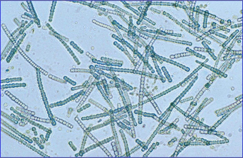 Photo of Cyanobacteria under a microscope